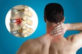 Пинғардаи vertebrae